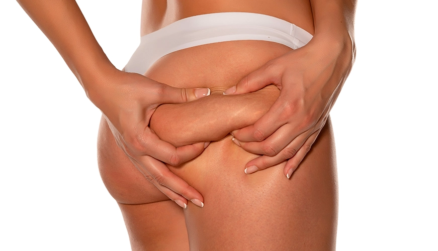 Essential_Aesthetics_Liposuction__Treatments_thighs